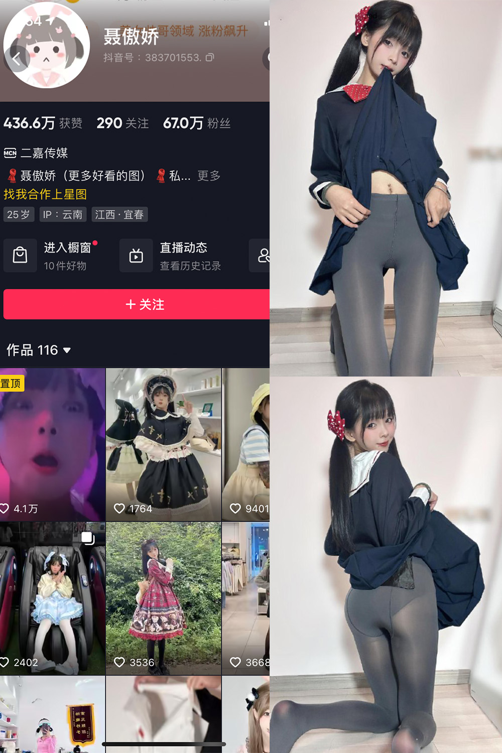 抖音 聂傲娇 微密圈  NO.066期 【23P】最新至：2024.5.9-微密空间